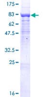 Human BTBD9 Protein (Recombinant GST)