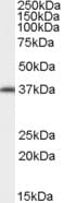 IHC-plus™ Polyclonal Goat anti-Human ARA9 / AIP Antibody (aa310-323, IHC, WB)
