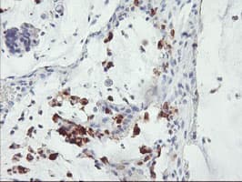 SDS Antibody (clone OTI1H5)