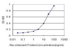 IHC-plus™ SGCB / SGC / Sarcoglycan Beta Antibody (clone 1E3)