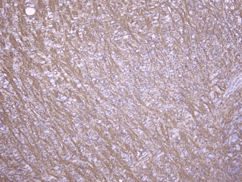 Polyclonal Rabbit anti-Human MOG Antibody (IHC, WB)