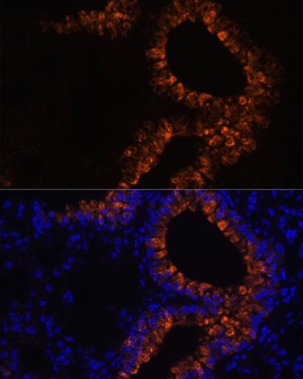 SCGB1A1 / Uteroglobin Antibody