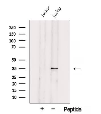 UCK2 Antibody