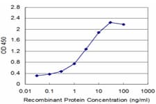 SMARCA2 / BRM Antibody (clone 2D12)