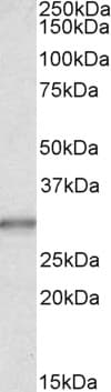 IHC-plus™ CA1 / Carbonic Anhydrase I Antibody (aa166-176)