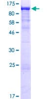 Human SMEK1 Protein (Recombinant GST)