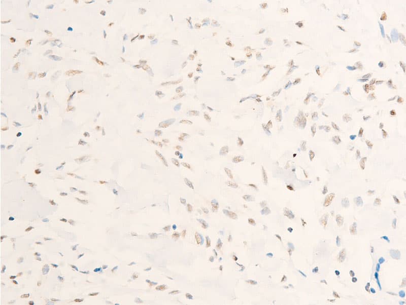 MYC / c-Myc Antibody (phospho-Thr58)