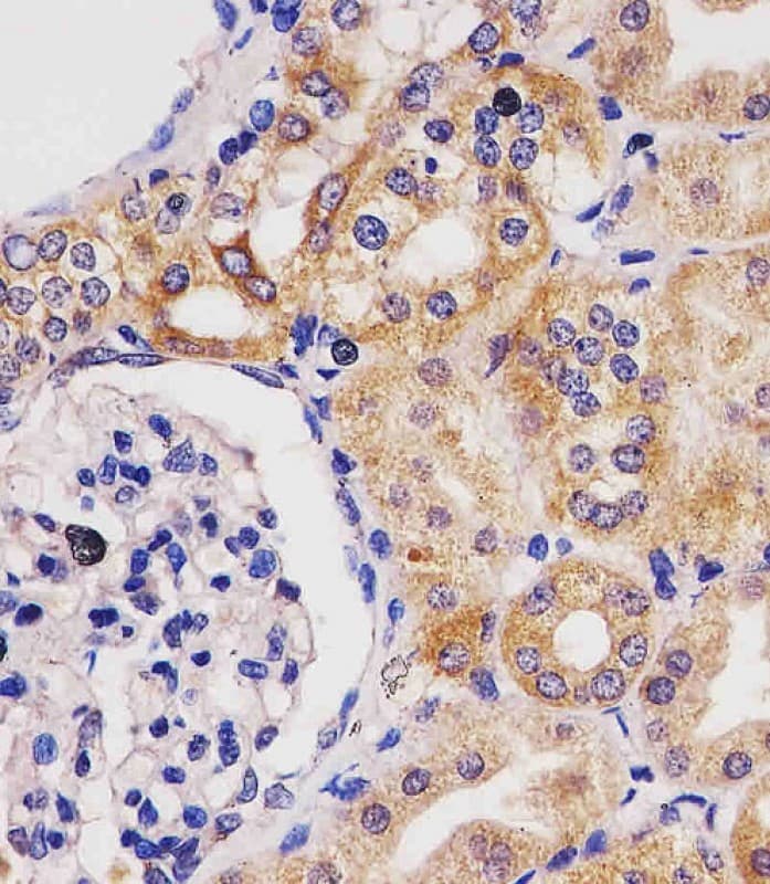 GLS2 / Glutaminase 2 Antibody (clone 1758CT879.217.60)