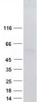 Human RBMS3 Protein (Recombinant Myc-DDK (Flag))