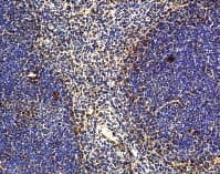 Polyclonal Rabbit anti-Mouse IL22 Antibody (aa40-67, IHC)