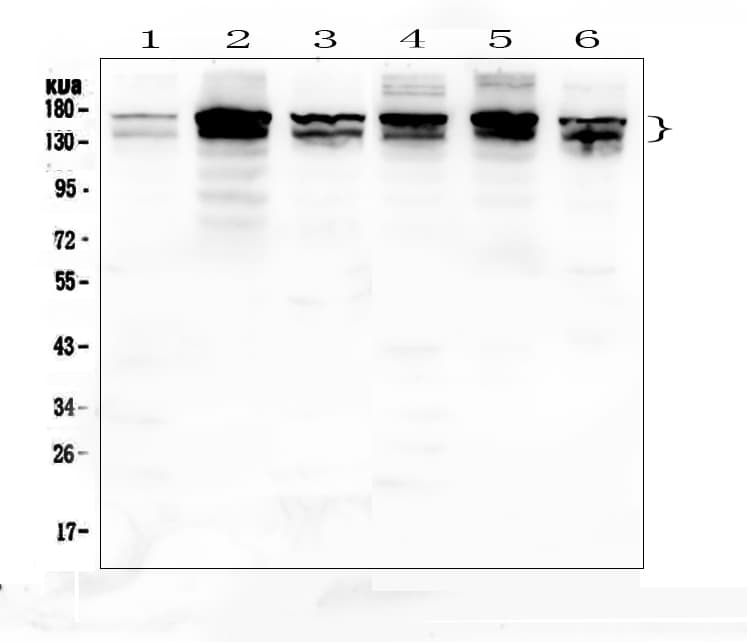 Polyclonal Rabbit anti-Human INPPL1 / SHIP2 Antibody (IHC, WB)