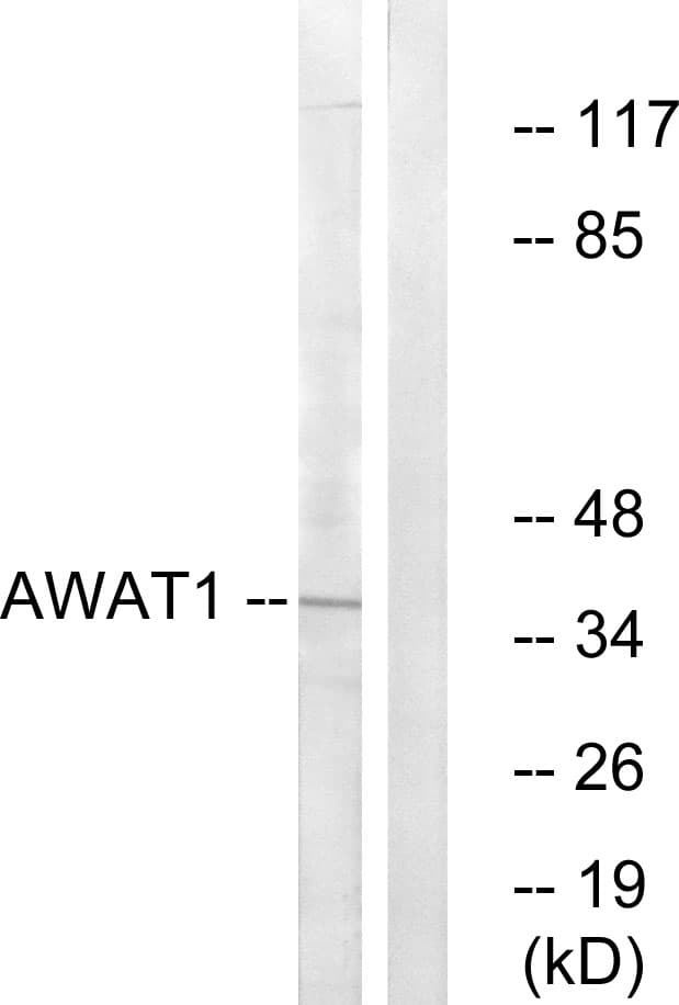 AWAT1 / DGAT2L3 Antibody (aa261-310)