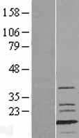 MLC3F / MYL1 Protein (Over-Expression Lysate Myc-DDK (Flag))