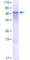 Human ZNF764 Protein (Recombinant GST)