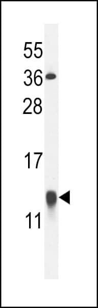 LGALS1 / Galectin 1 Antibody