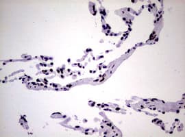 NBN / Nibrin Antibody (clone OTI6E11)