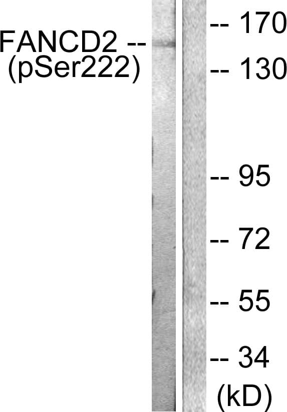 FANCD2 Antibody (phospho-Ser222)