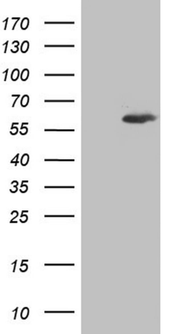 Monoclonal Mouse anti-Human IKZF3 / AIOLOS Antibody (clone OTI7E11, aa1-301, IHC, WB)