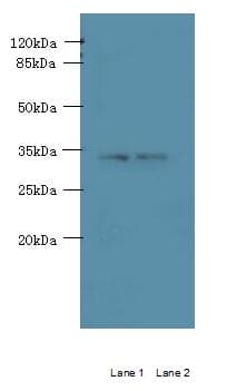 C3orf49 Antibody