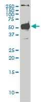 Monoclonal Mouse anti-Human STK38 Antibody (clone 2G8-1F3, IHC, IF, WB)