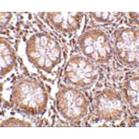 TEM1 / CD248 Antibody