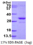 Human SNF8 / EAP30 Protein (Recombinant His)