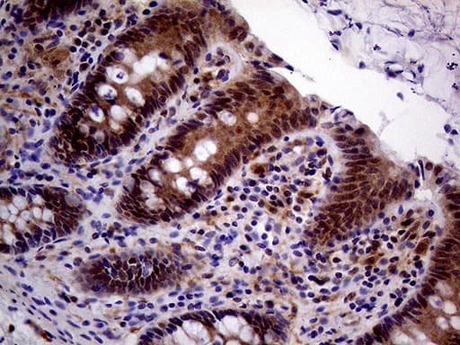 PCMT1 Antibody (aa60-285, clone OTI2A9)
