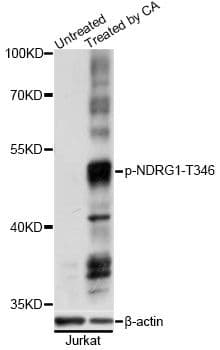 Polyclonal Rabbit anti-Human NDRG1 Antibody (phospho-Thr346, WB)