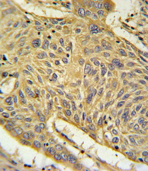 AGER / RAGE Antibody (aa24-52)