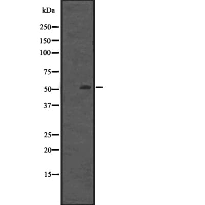 NACC1 / NAC1 Antibody