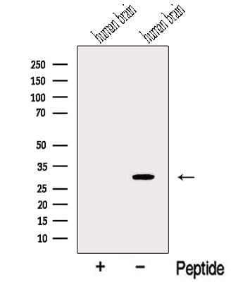 MYOZ2 / CS-1 Antibody