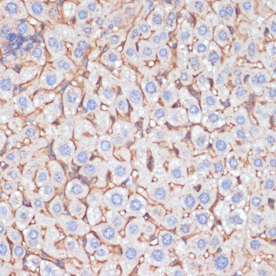 APOA1 / Apolipoprotein A 1 Antibody