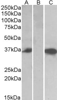 IHC-plus™ CMA1 / Mast Cell Chymase Antibody (aa96-110)