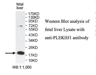 IHC-plus™ PLEKHJ1 Antibody (aa1-147)