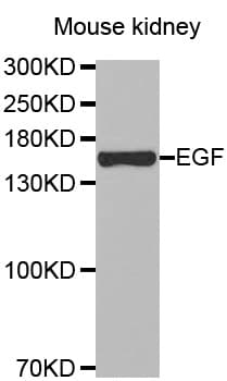 Polyclonal Rabbit anti-Human EGF Antibody (IHC, WB)