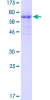 Human WTAP Protein (Recombinant GST)