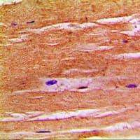 Polyclonal Rabbit anti-Human SLC9A8 / NHE8 Antibody (C-Terminus, IHC, IF, WB)