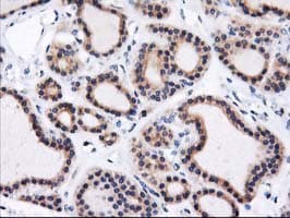 HMOX2 / Heme Oxygenase 2 Antibody (clone OTI1B4)