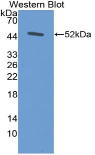 LAMC2 / Laminin Gamma 2 Antibody (aa416-602)