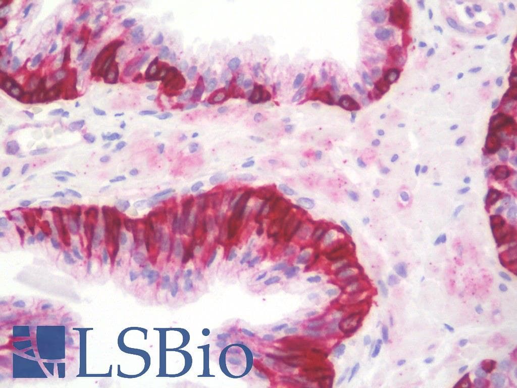 IHC-plus™ Polyclonal Rabbit anti-Human NCBP1 / CBP80 Antibody (IHC, WB)