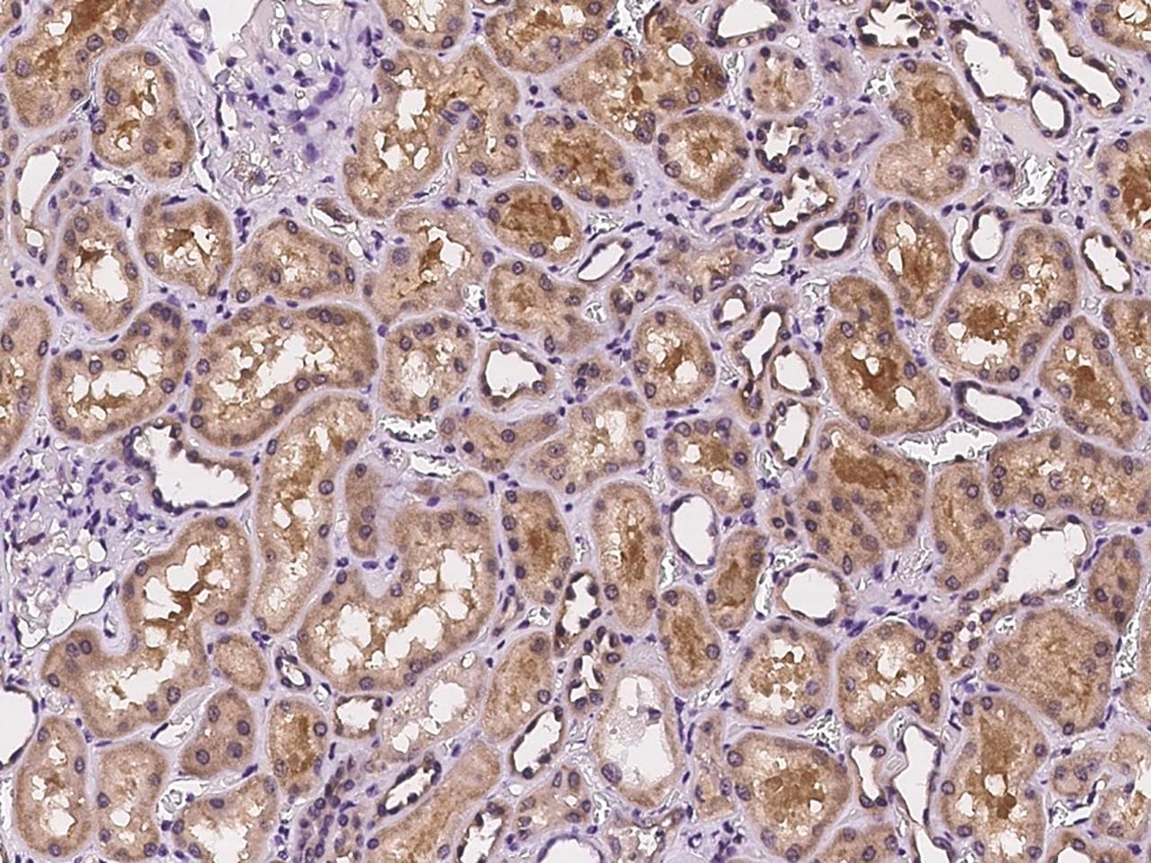 CNNM3 Antibody