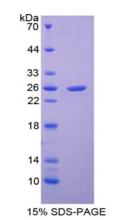 Human SP100 Protein (Recombinant His-T7)