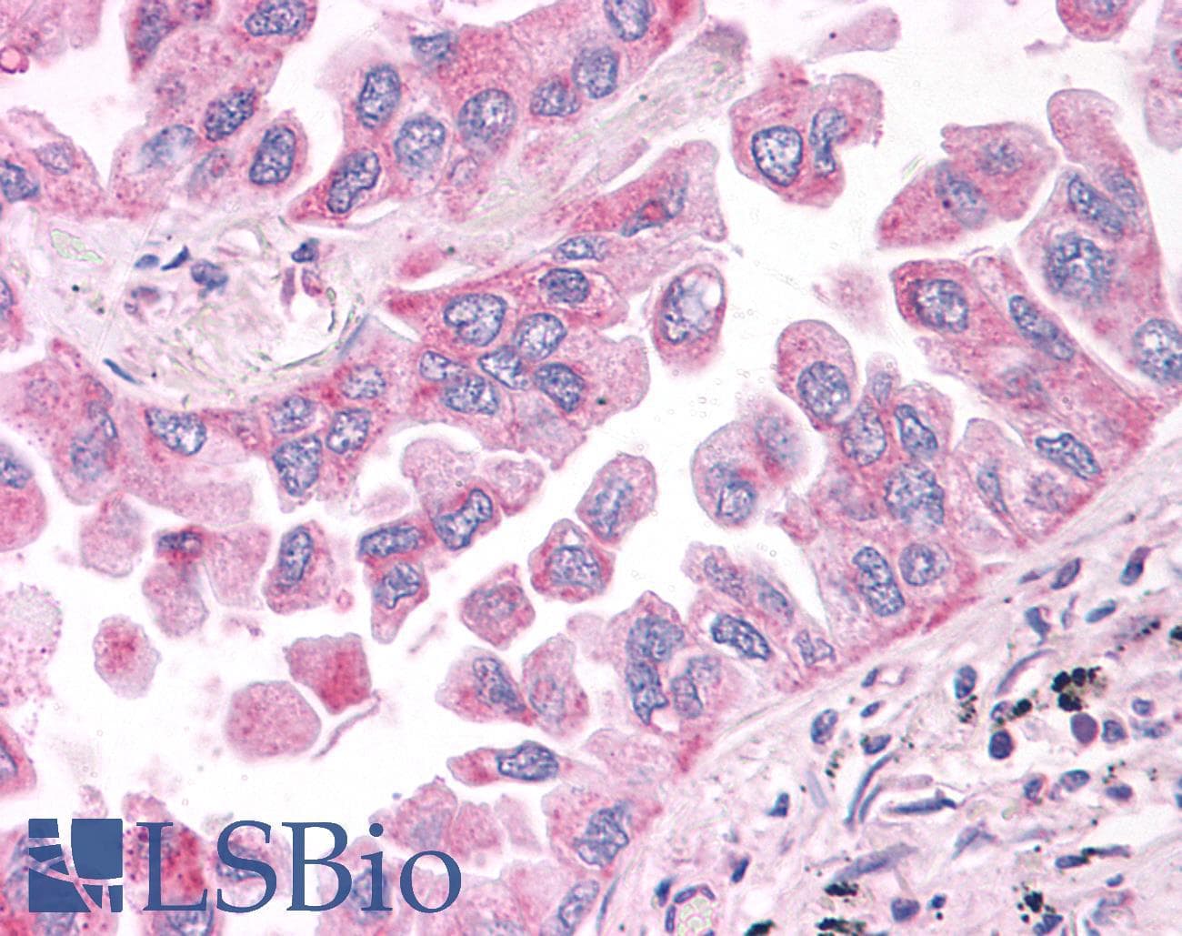 PathPlus™ NEK6 Antibody (N-Terminus)