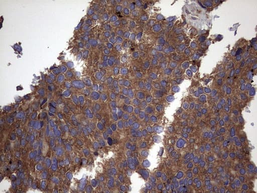 IL1RN Antibody (clone OTI2B1)