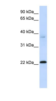 C11orf74 Antibody (C-Terminus)