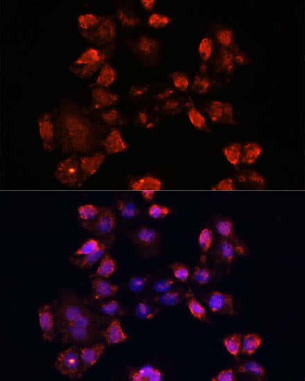 Polyclonal Rabbit anti-Human DAZL Antibody (IHC, IF, WB)