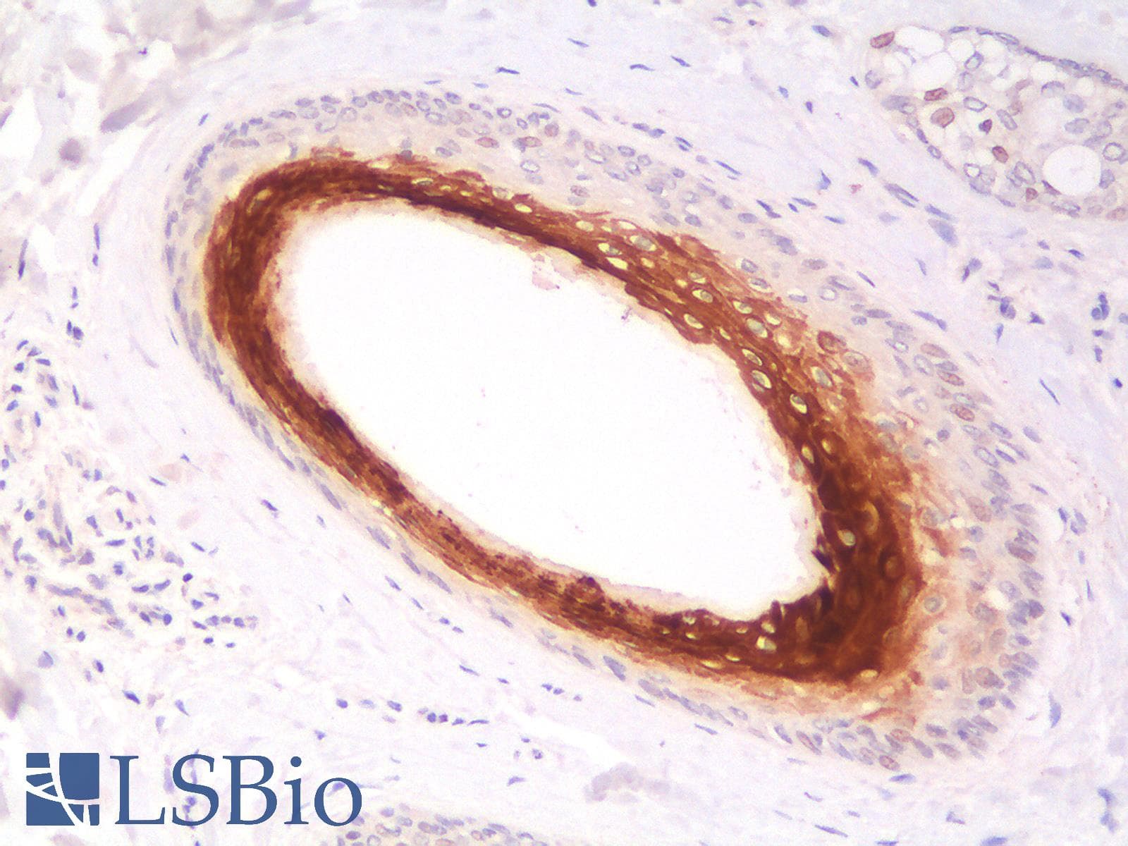 PathPlus™ Recombinant Monoclonal Mouse anti-Human KRT16 / CK16 / Cytokeratin 16 Antibody (clone KRT16/1714, C-Terminus, IHC)