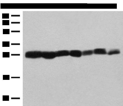 Polyclonal Rabbit anti-Human PSMA3 Antibody (IHC, WB)