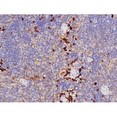 Polyclonal Rabbit anti-Human MAPT / Tau Antibody (phospho-Thr212, IHC, WB)
