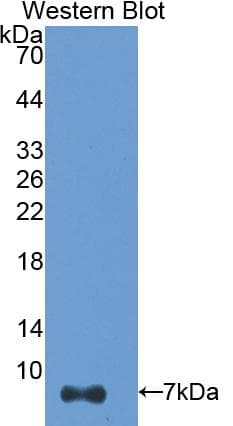 TMSB4X / Thymosin Beta-4 Antibody (aa1-44)